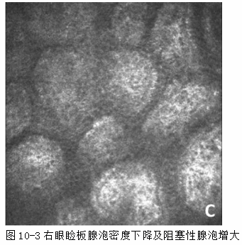 ZY016_46_4.gif